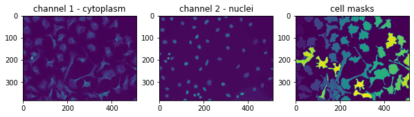 ../../_images/cellular_segmentation_24_1.png